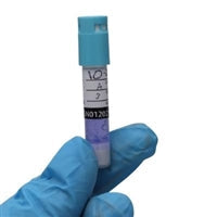 Biological Indicators